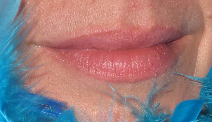 Labios resecos y agrietados Consigue labios hidratados y tentadores este verano