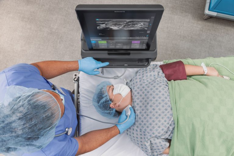 FUJIFILM Sonosite presenta el ecógrafo totalmente táctil para POCUS Sonosite ST