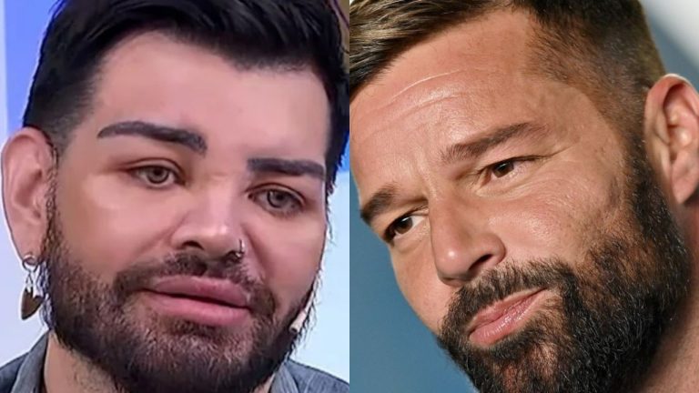 Un hombre se opera para parecerse a Ricky Martin, y acaba siendo Gabriel Rufián