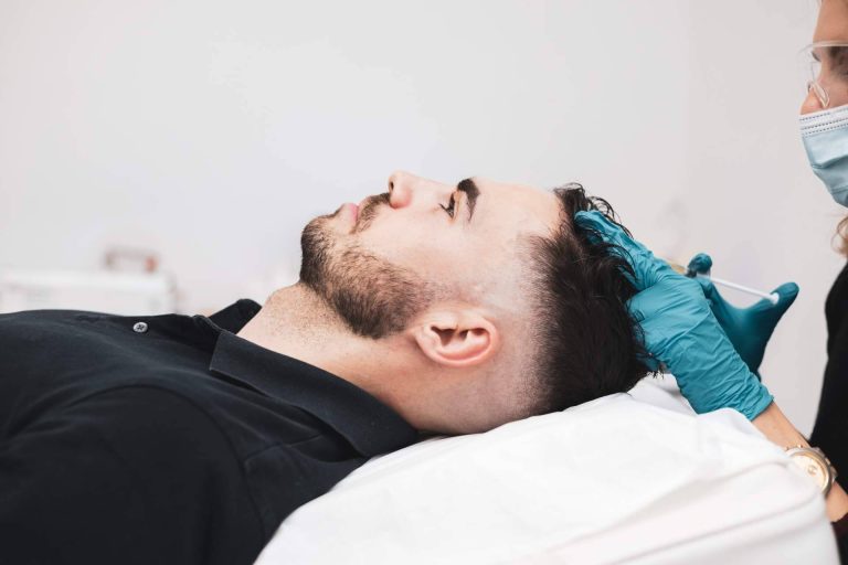 El tratamiento innovador de Centro Estética El Pilar que estimula el crecimiento del cabello, PRP capilar