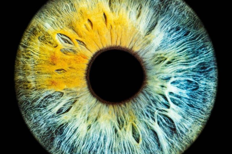 Cómo es el perfil psicológico sano de los pacientes que realizan láser de cambio de color de ojos