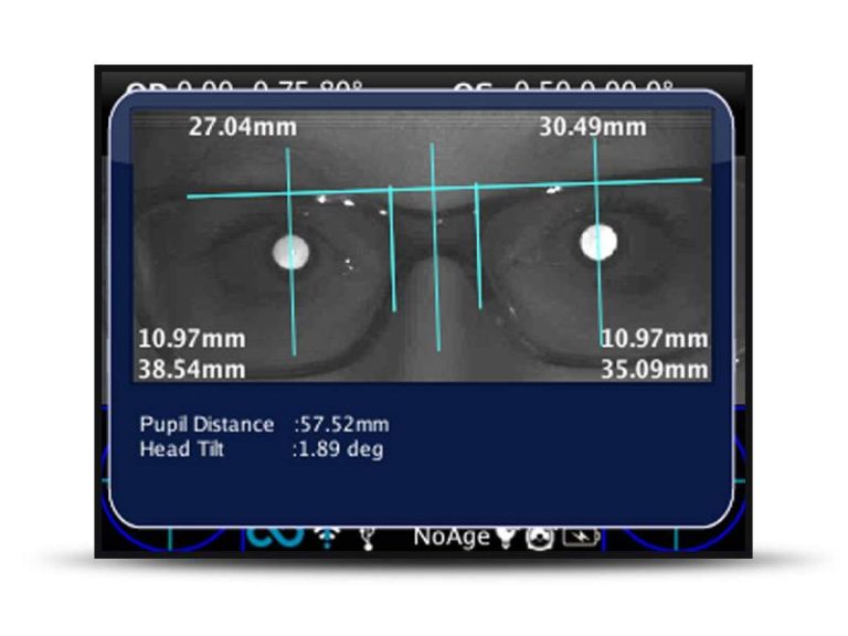 GX2 analiza el estado de salud general y específico de la córnea con el microscopio especular