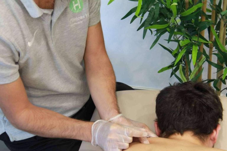 Punción seca para patologías músculo esqueléticas, de la mano de Clínicas H3