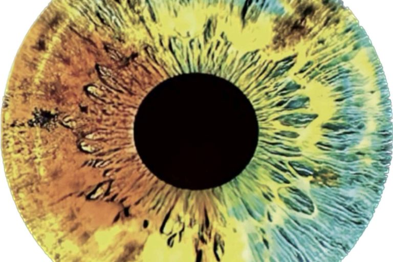 Los diferentes tipos de melanina, por Clínica Eyecos