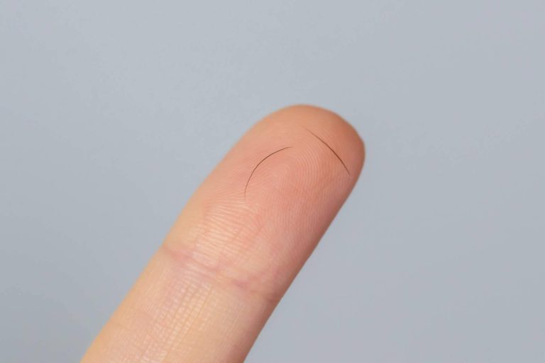 El Doctor Jesús Mora y Capilar Innovation Clinic explican por qué se cae el pelo de las cejas