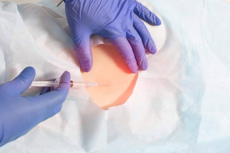 La Unidad de Columna y Traumatología de Biziondo habla del tratamiento de ozonoterapia