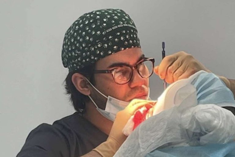 El microinjerto FUE zafiro para hombres y mujeres, de la mano del doctor Jesús Mora y Capilar Innovation Clinic
