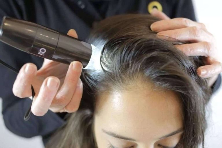 Los más de 20 años poniendo solución a la alopecia areata de IMD