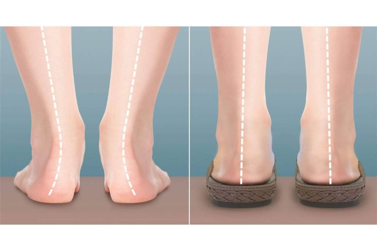 Arcos de soporte, la tecnología de Aetrex para cuidar de los pies