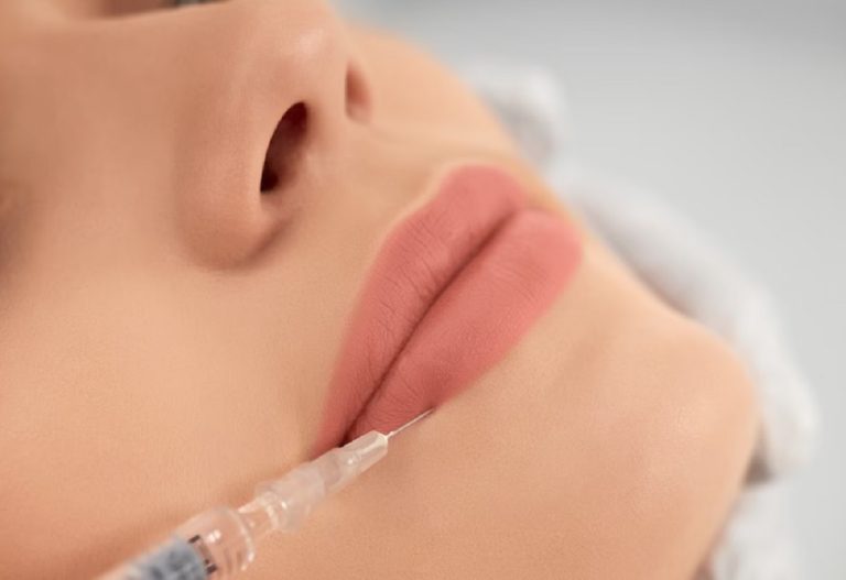 Todo lo que hay que saber sobre el aumento de labios