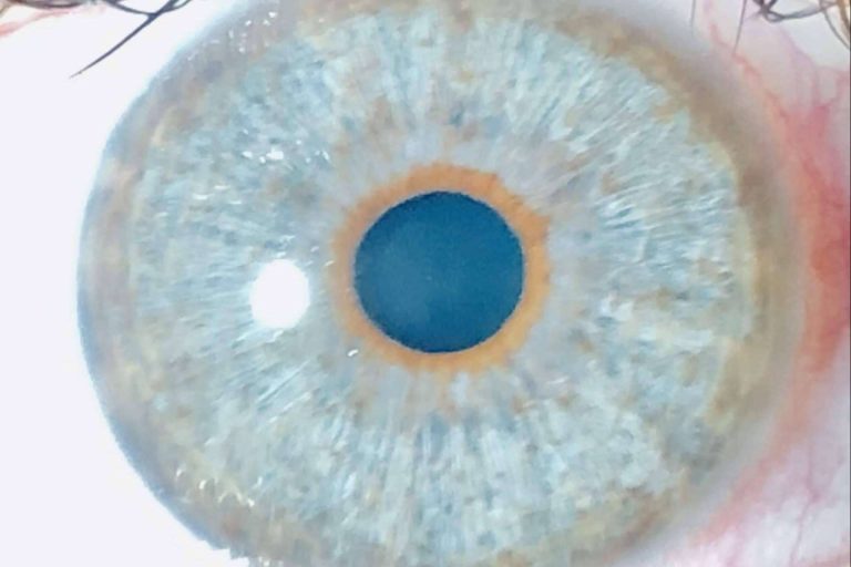 Distribución del color de ojos de la mano de Eyecos