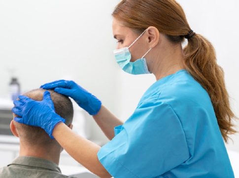 tratamientos para la alopecia