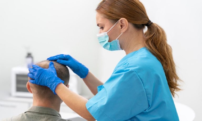 Cuáles son los mejores tratamientos para eliminar la alopecia