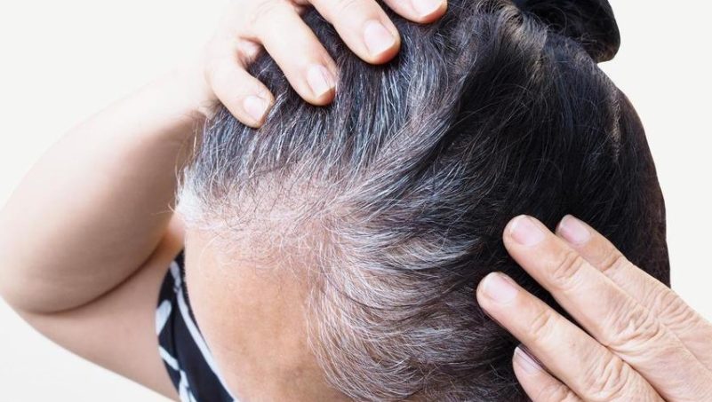 Las razones por las que te salen canas de joven, según un estudio de Harvard