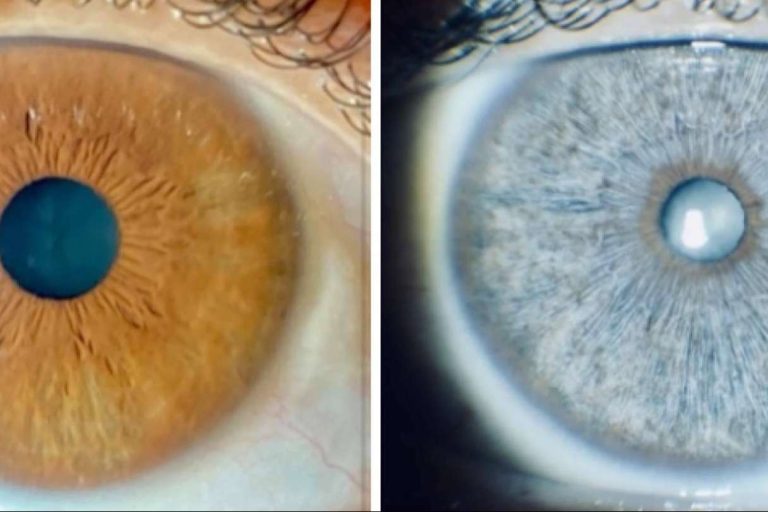 Los sueros crece pestañas pueden oscurecer los ojos de forma permanente