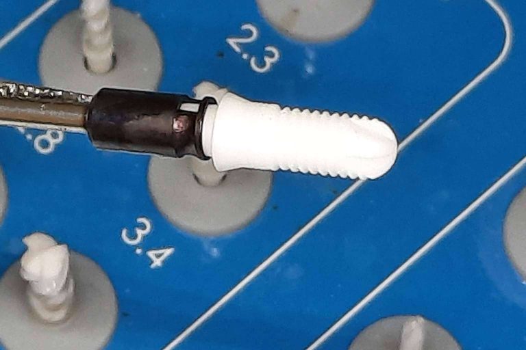 Clínica Biorigenera realiza implantes dentales biocerámicos