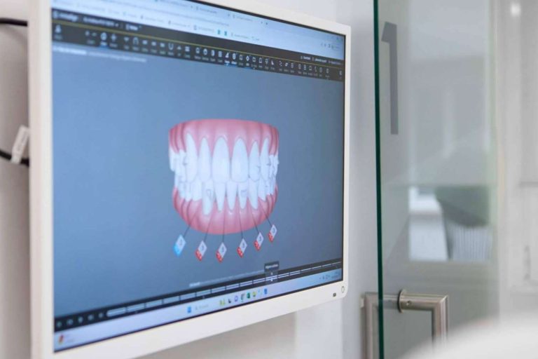 Tratar la maloclusión dental con CLÍNICA CRISTINA VIYUELA + CO y la ortodoncia invisible Invisalign