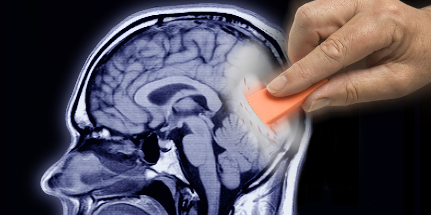 Alzheimer: Señales tempranas y cómo detener su avance 2 ENFOQUES INNOVADORES EN EL TRATAMIENTO