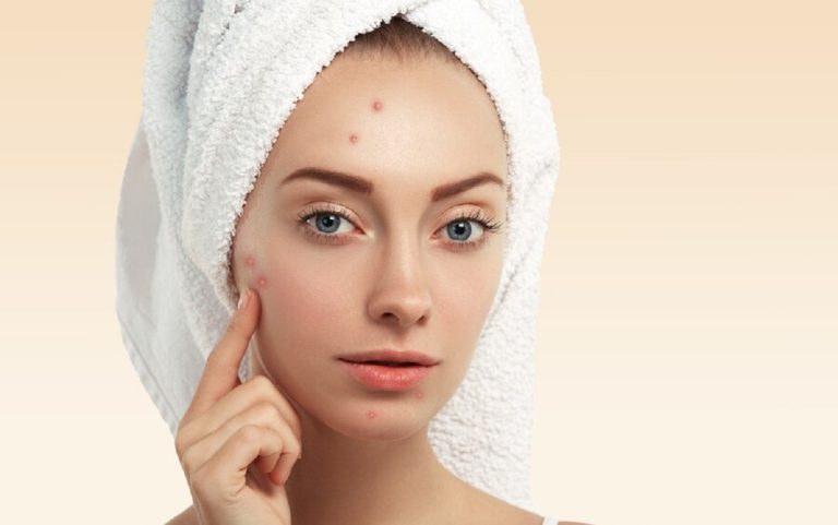 ¿Cómo afecta el ciclo menstrual a la piel?