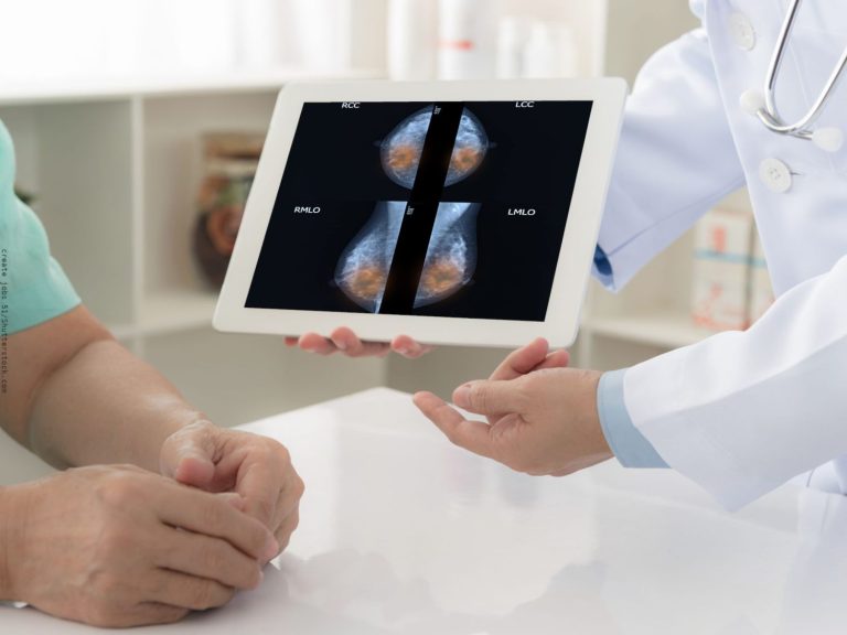 El 96% de hombres con cáncer de mama se someten a mastectomías, según experto