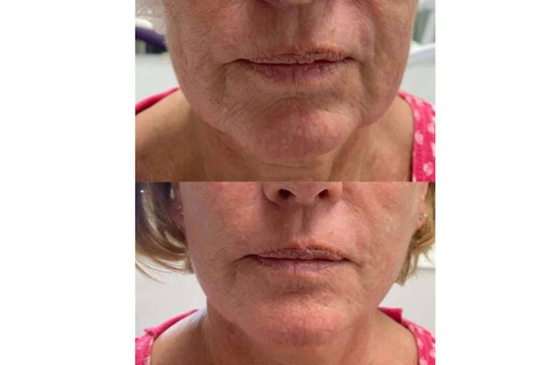 Las claves de los tratamientos de Dr. Guidi en medicina estética facial