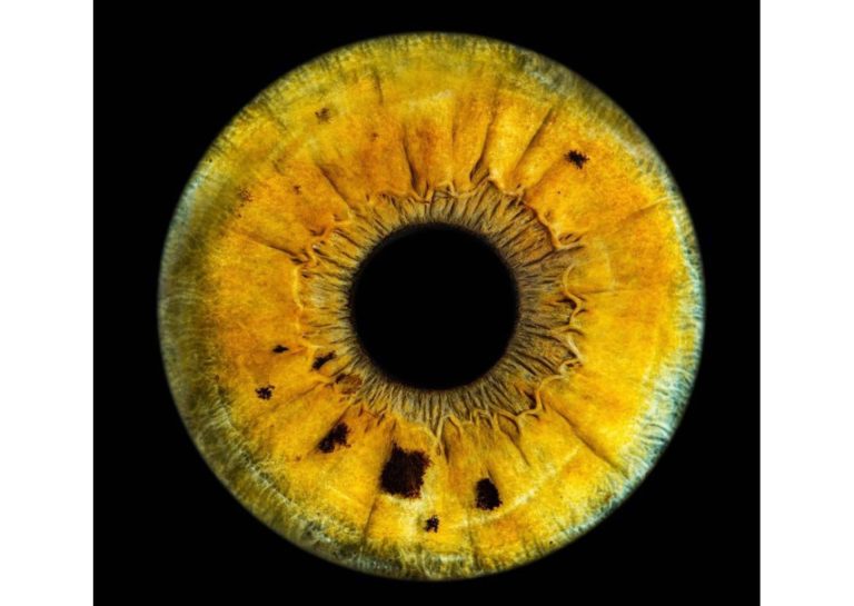 El software con tecnología puntera para evaluar el color de los ojos de la clínica Eyecos