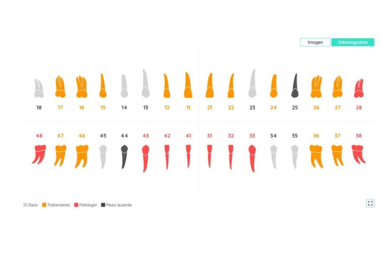 El uso de la visión artificial en el mundo odontológico de la mano de Dentomo