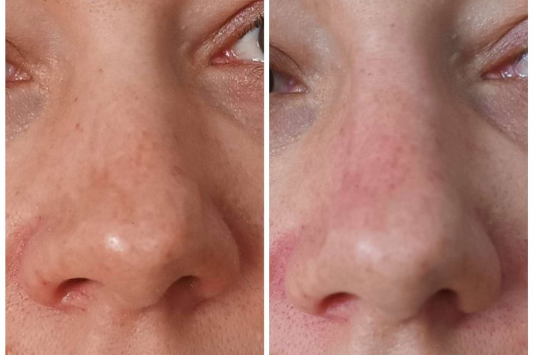 Medicina estética facial y dental para una sonrisa perfecta de la mano de Clínica Calvo de Mora