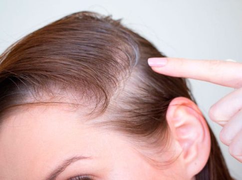 Champú anticanas para cabello.