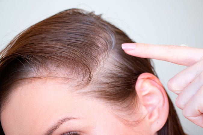 Champú anticanas para cabello.