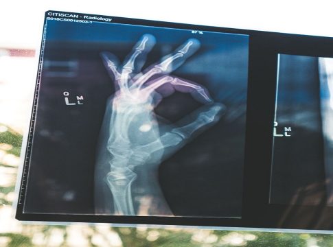 beneficios de la fisioterapia beneficios de la fisioterapia