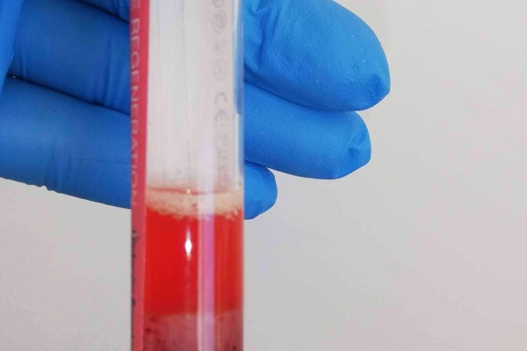 Clínica Biorigenera cuenta con expertos en terapias con células madre