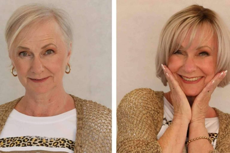 Para mujeres con alopecia o el cabello muy fino, microlíneas, la prótesis capilar indetectable de Fermín Peluqueros, es una solución ideal