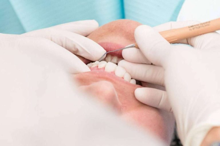 ¿Cómo prevenir y tratar las enfermedades periodontales?