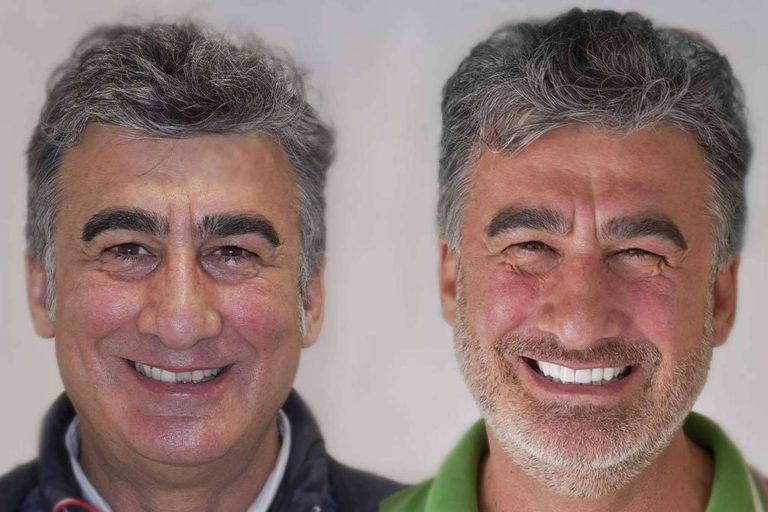 Denty Dent, especialistas en tratamientos de estética dental