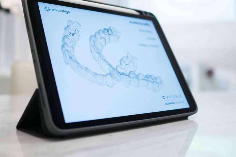 ¿Qué diferencia a un ortodoncista de otro en la ortodoncia invisible con la técnica Invisalign?, por Doctora Viyuela