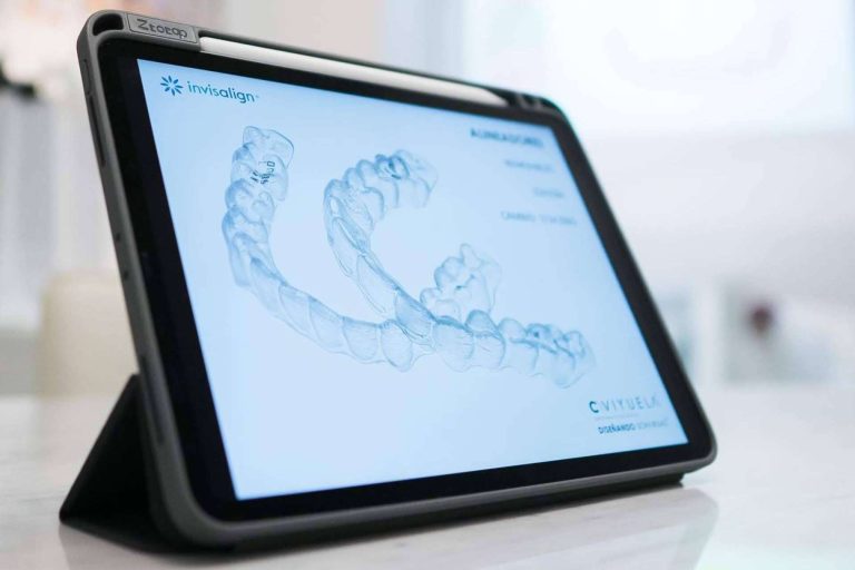 ¿Cuál es el precio de Invisalign? Toda la información acerca de los precios de la ortodoncia invisible más buscada