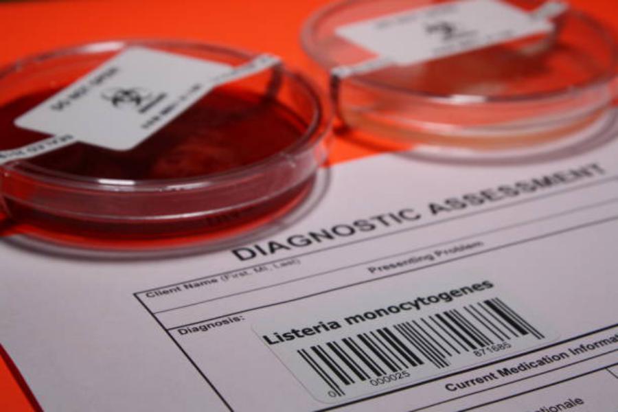 Recomendaciones de la Aesan