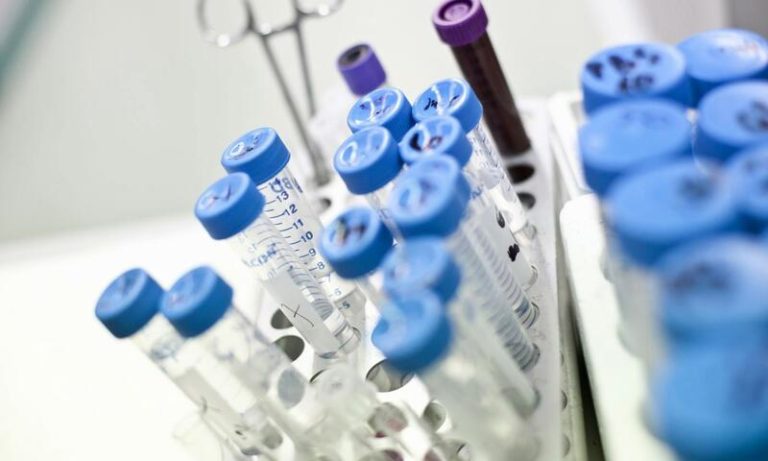 Un estudio de un caso de cáncer de mama triple negativo revela los factores que influyen en su progreso