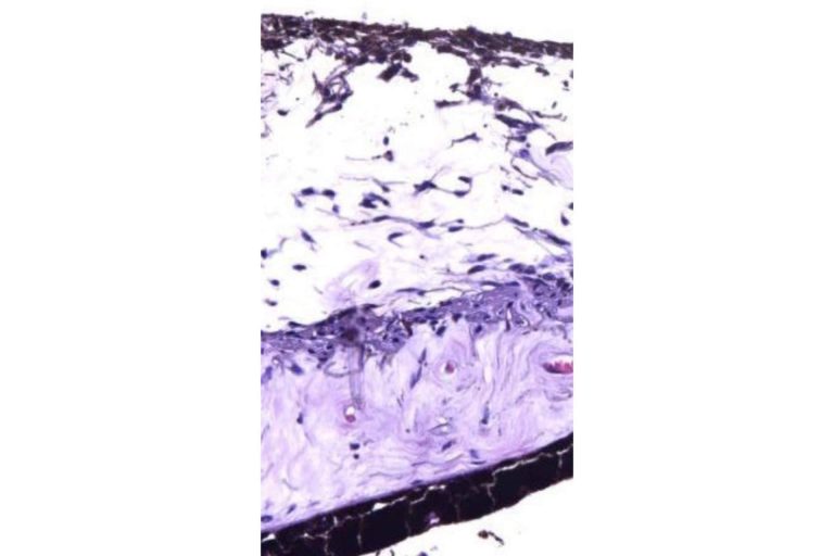 La clínica Eyecos explica cómo la histología del iris influye en el color de los ojos