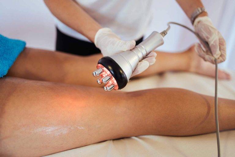 Tratamientos efectivos para eliminar estrías en el Centro Estética El Pilar