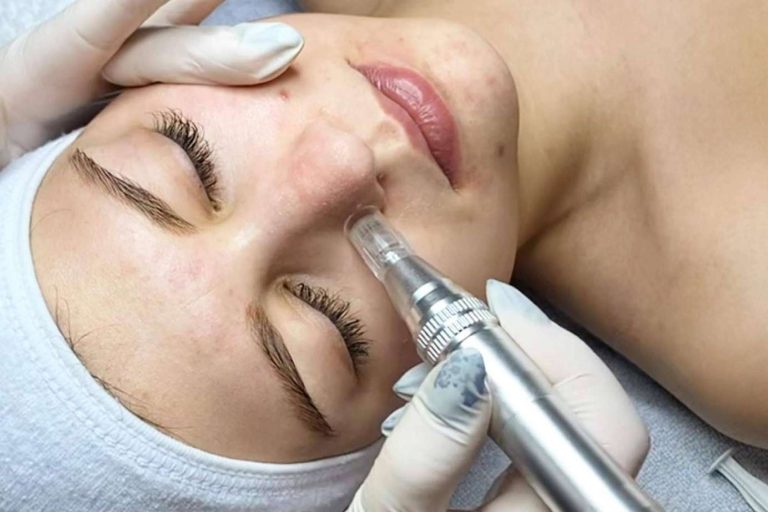 Cynthia Micro & Beauty, un centro de estética profesional en Terrassa y Madrid