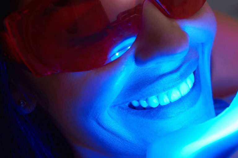 Lograr una apariencia radiante de la dentadura gracias al blanqueamiento dental avanzado con luz LED