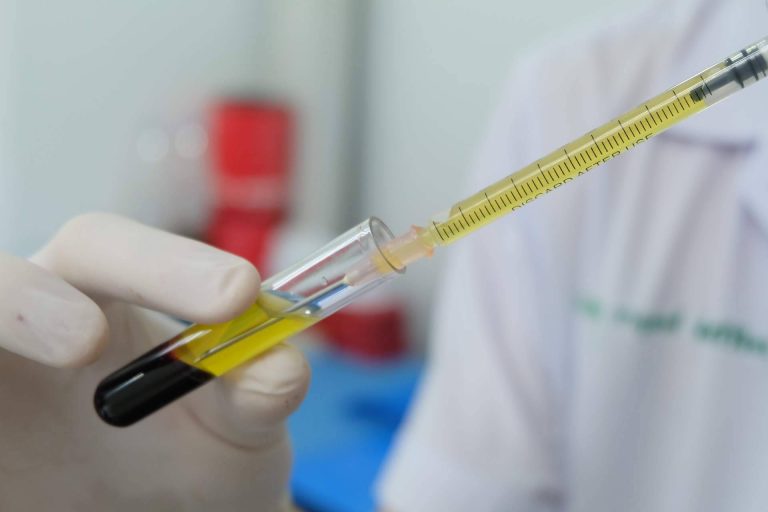 El innovador tratamiento de plasma rico en plaquetas de Centro Estética El Pilar