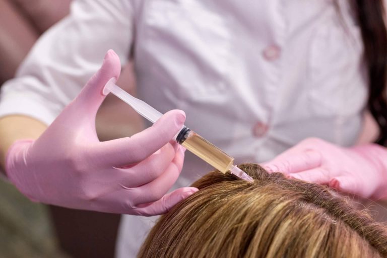 Capilar Innovation Clinic By Doctor Jesús Aníbal Mora explica cómo solucionar la alopecia difusa femenina capilar