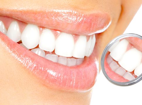 Cómo eliminar naturalmente las manchas en los dientes