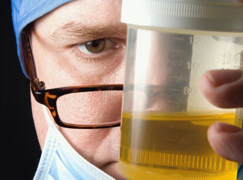 La razón por la que la orina siempre es de color amarillo