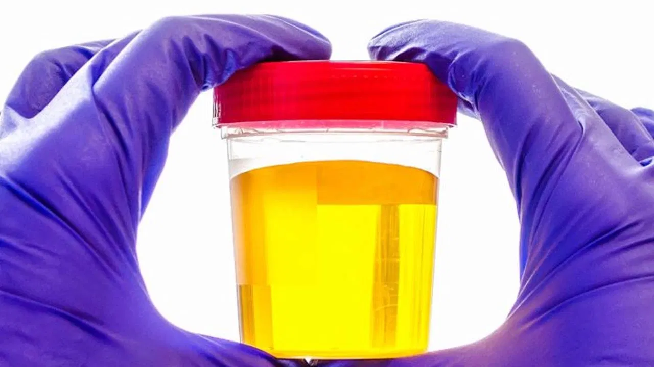 CONCLUSIONES FINALES