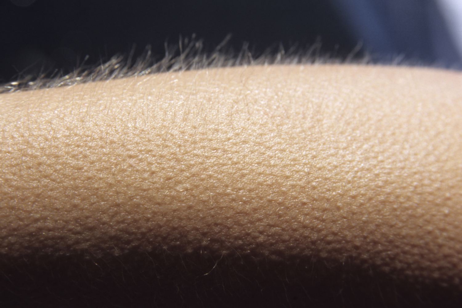 La razón por la que se nos pone la carne de gallina 3 ASPECTOS CULTURALES Y SOCIALES DE LA PIOLOERECCIÓN