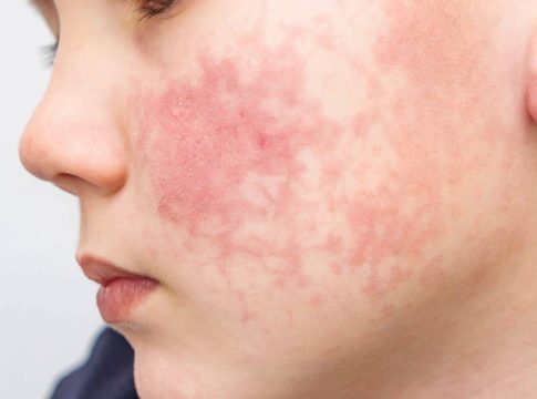 Lo que le pasa a tu piel si no lavas la almohada de la cama